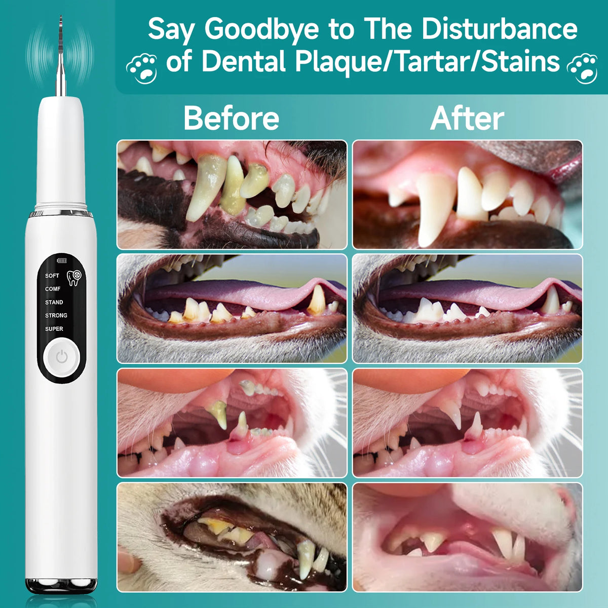 Alerion™ - Ultrasonic Plaque Remover