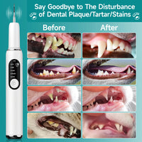 Alerion™ - Ultrasonic Plaque Remover